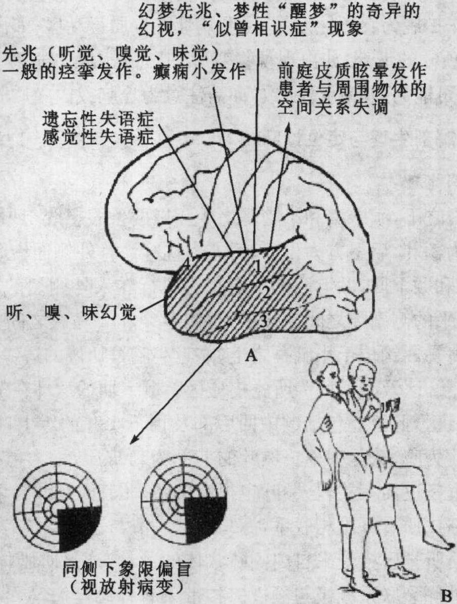 第一節(jié) 大腦皮層病變的解剖生理與定位診斷